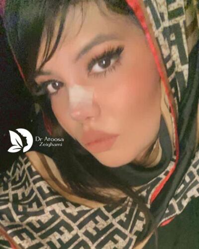 عمل-بینی-744