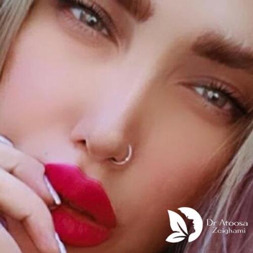عمل-بینی-758