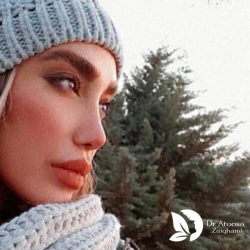عمل-بینی-759