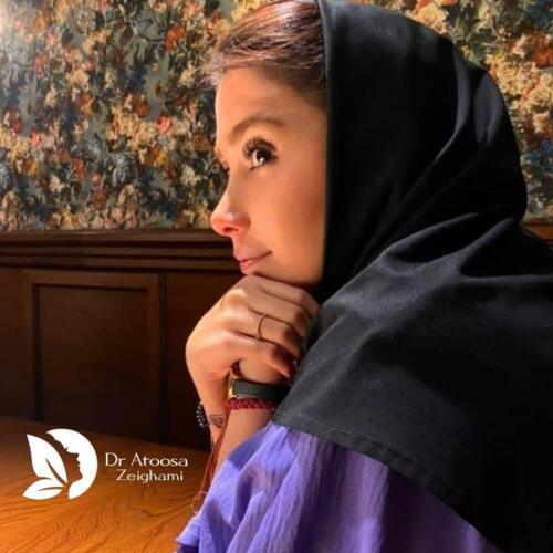 عمل-بینی-763