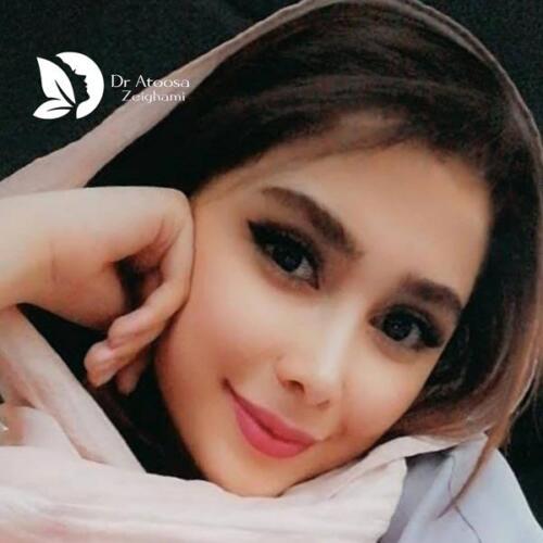 عمل-بینی-764
