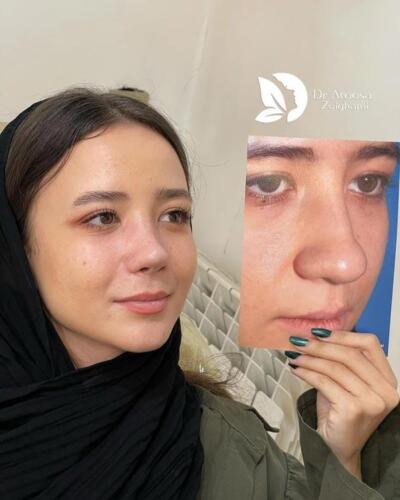 عمل-بینی-766