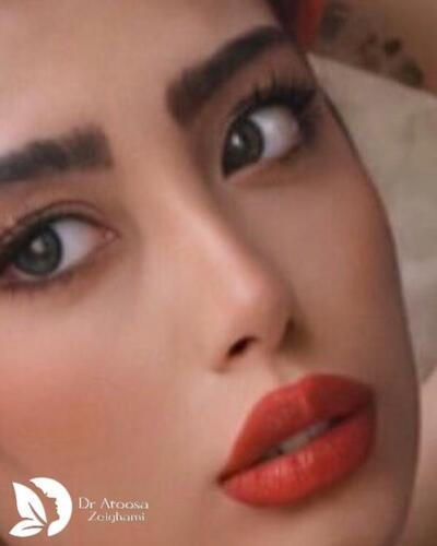 عمل-بینی-773