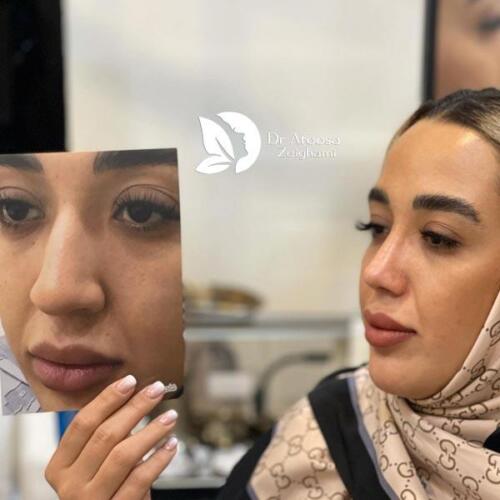 عمل-بینی-776