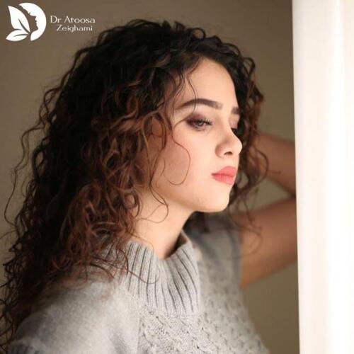 عمل-بینی-785
